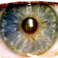 eye